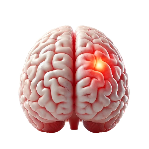 Metabolic encephalopathy